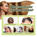 Fast Hair Growth Oil Africa Crazy Traction Alopecia Serum Anti Hair Break Thicken Hair Loss Treatment Spray Beauty Health - M & M Global