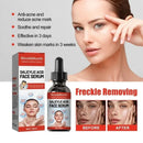 Niacinamide Facial Serum Salicylic Acid Moisturizing Skin Care Products 2024 - M & M Global
