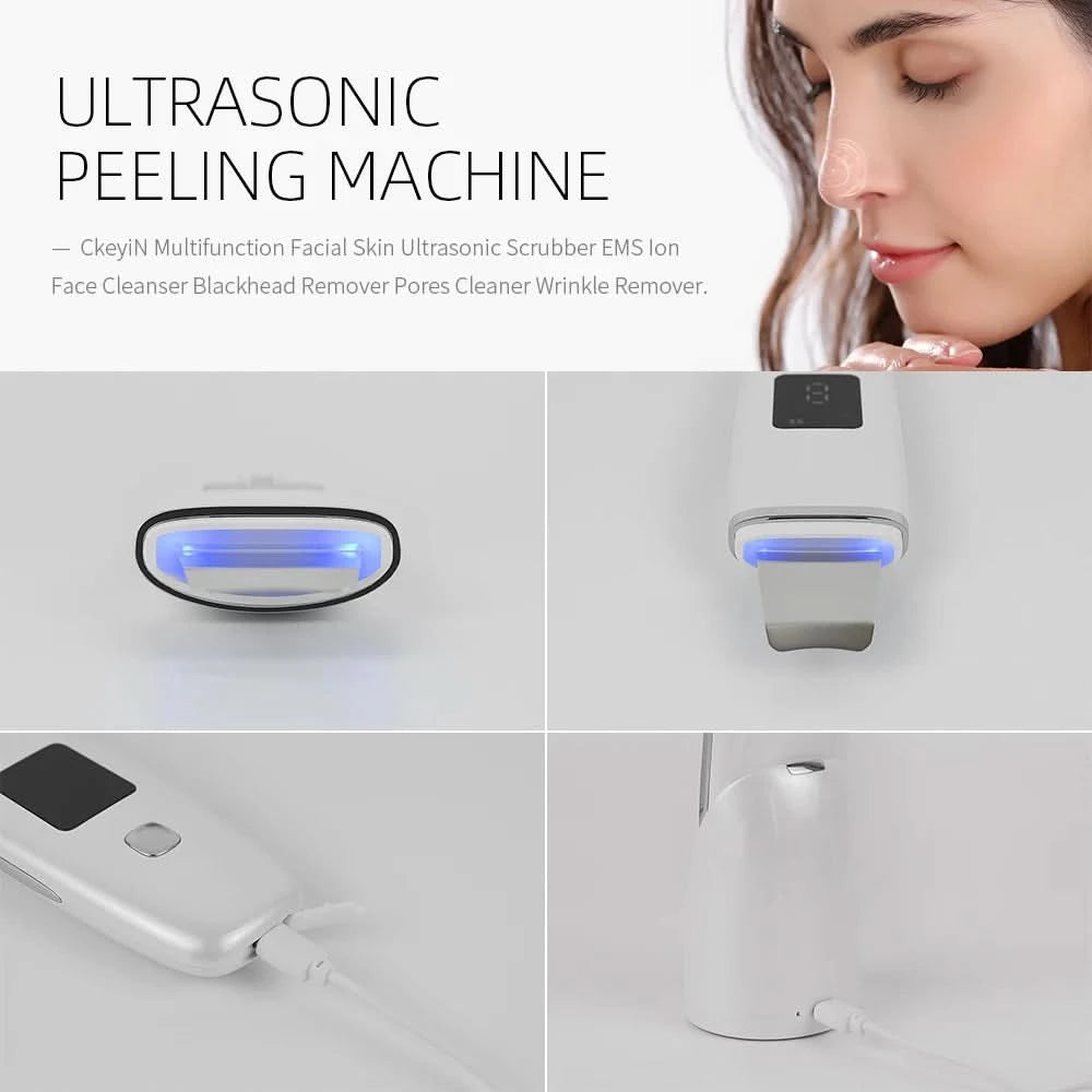 Ultrasonic Skin Scrubber Facial Spatula Blackhead Remover Deep Face Cleaning Lift Machine Peeling Shovel Pore Cleaner - M & M Global