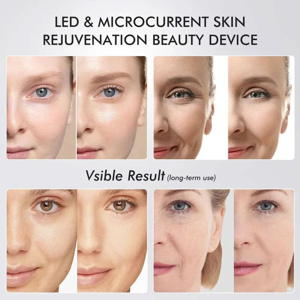 6 in 1 Age Booster Skin Care Facial Glow Booster Beauty Device Facial Skin Care Tools Anti Aging Microcurrent Lift Face Care - M & M Global
