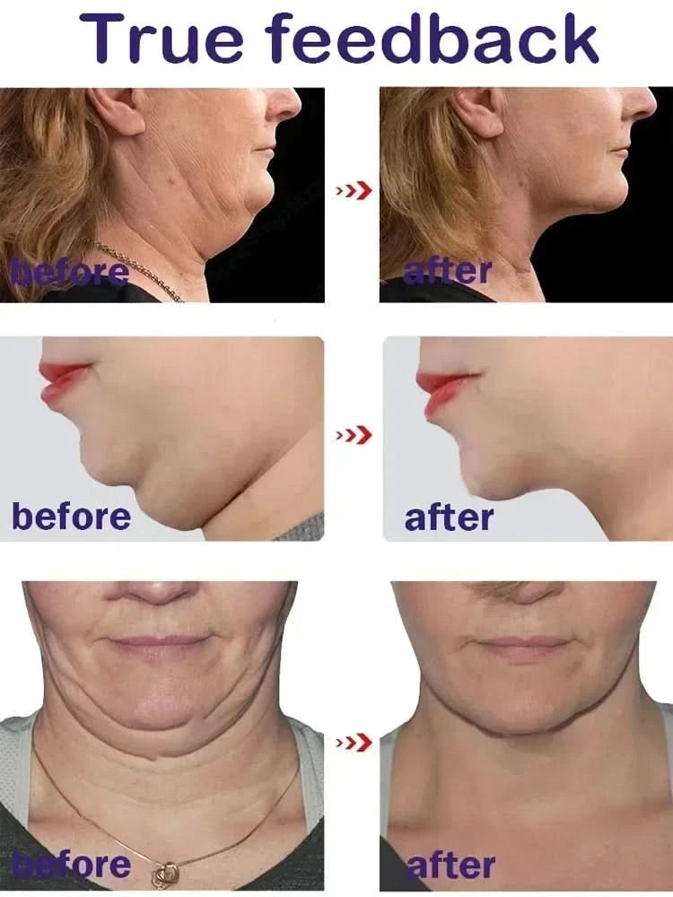 Effective V-Shape Face Slimming Lifting Facial Cream Lift Up V Double Chin Cheek Slimming Firming Anti Wrinkle Beauty Skin Care - M & M Global