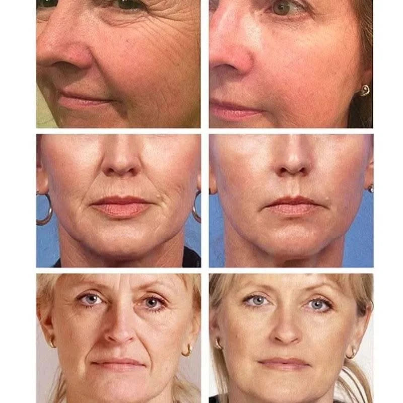 Caviar Wrinkle Remover Face Cream Free Eye Mask Collagen Lifting Firming Fade Fine Lines Anti-aging Moisturizing Korean Cosmetic - M & M Global