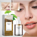 Korean Centella Asiatica Face Serum Nourish Dry Skin Smoothing Rejuvenation Skin Brightening Whitening Cream Facial Moisturizer - M & M Global