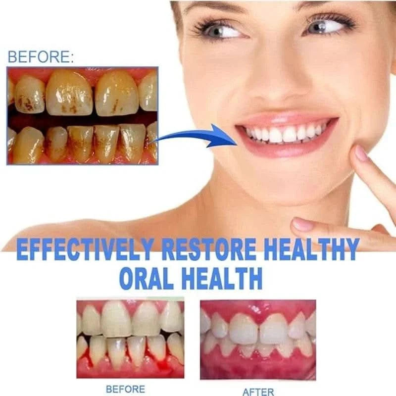 5-Pack Dental Repair Gel Relieves Inflamed Gums and Reduces Bad Breath Deep Clean Tooth Dirt Care Gums Fresh Breath Care Gel - M & M Global