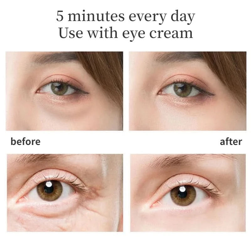Thermal Eye Beauty Devices Fade Black Circle Anti Wrinkle Beauty Pen Eye Cream Introduction 42 ° Vibration Massage Tools - M & M Global