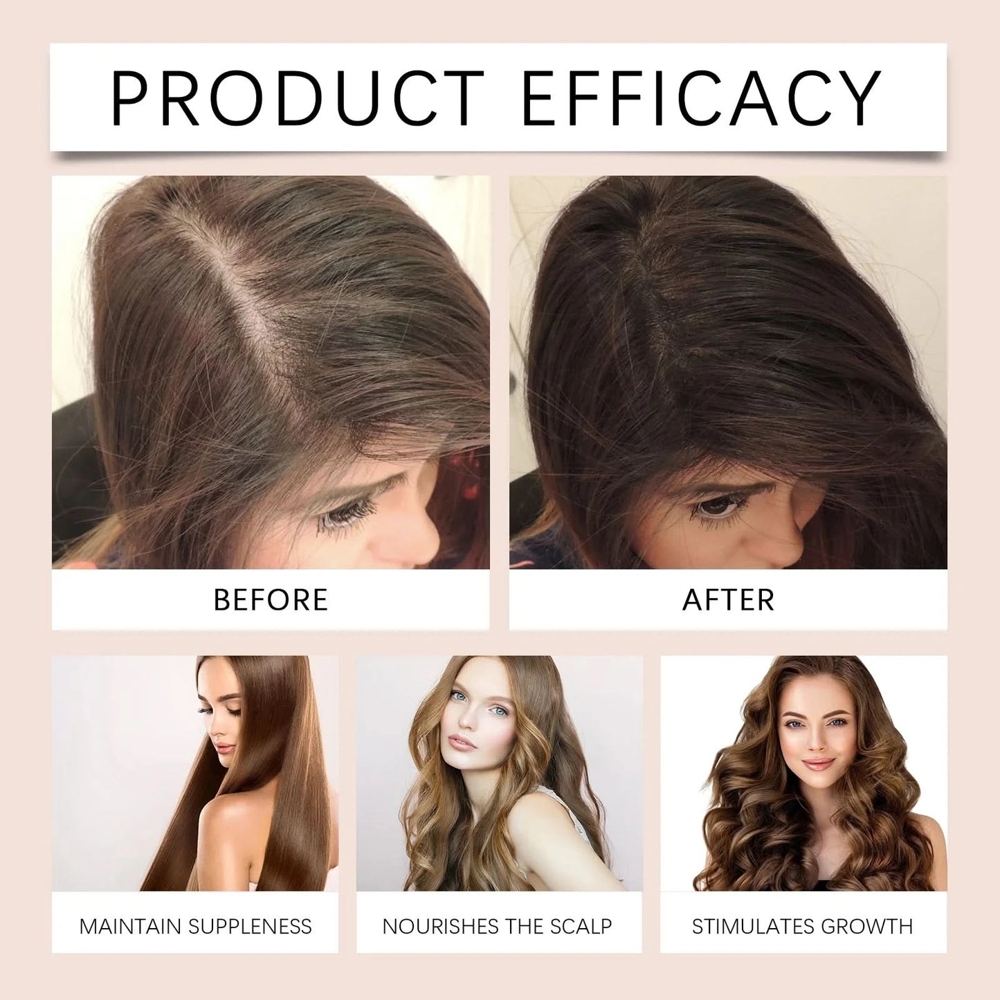 Hair Growth Oil Reduce Loss Keep Smooth Atomizing Nourishing Damage Baldness Essential Scalp Treatment Black Hair Care Essence - M & M Global