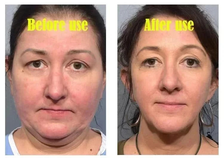 Effective V-Shape Face Slimming Lifting Facial Cream Lift Up V Double Chin Cheek Slimming Firming Anti Wrinkle Beauty Skin Care - M & M Global