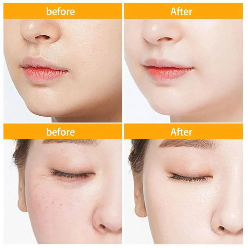 30/150Pcs Hyaluronic Acid Capsules Serum Hydrating Repair Moisturizing Essence Liquid Facial Deeply Nourishes Firming Skin Care - M & M Global