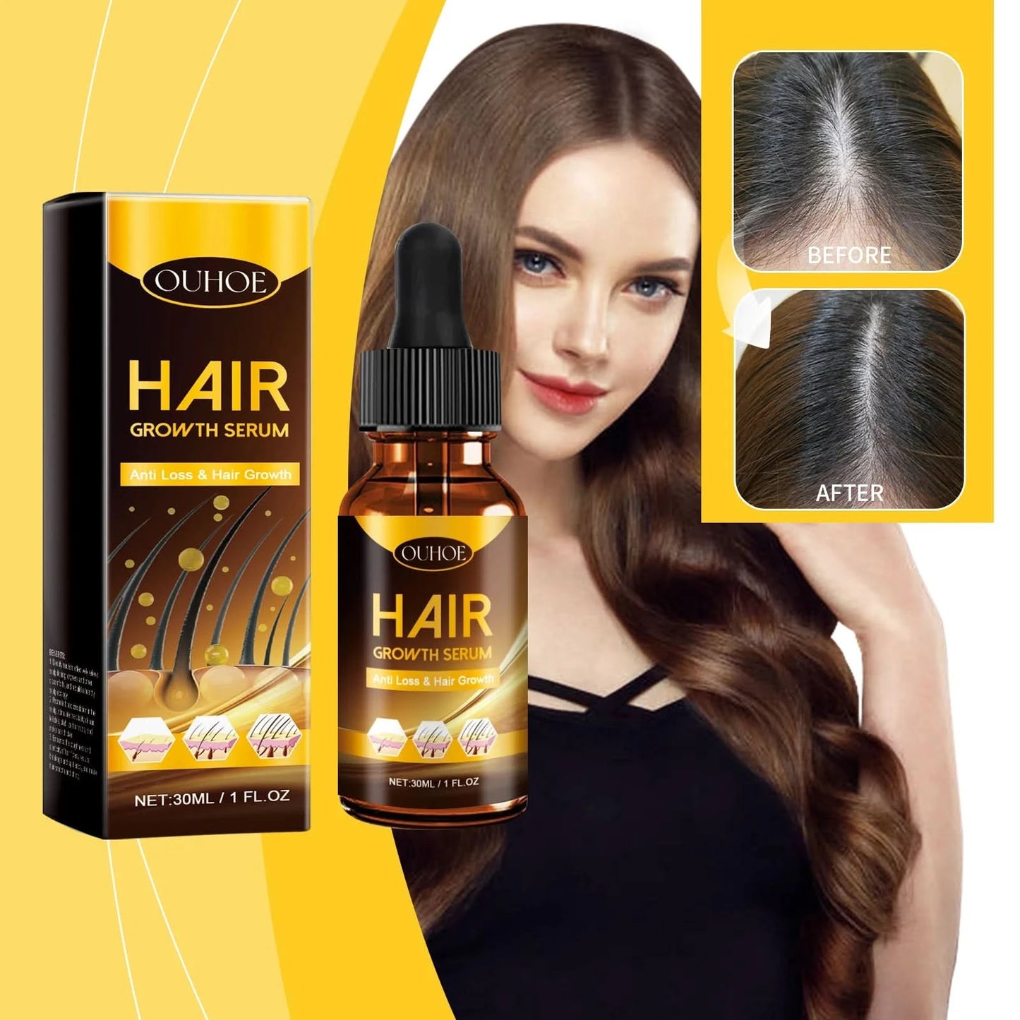 Hair Follicle Essence Deep Repair Damage Nourishing Growth Smoothing Oil Promote Regeneration Hydrate Fixing Dense Hair Products - M & M Global