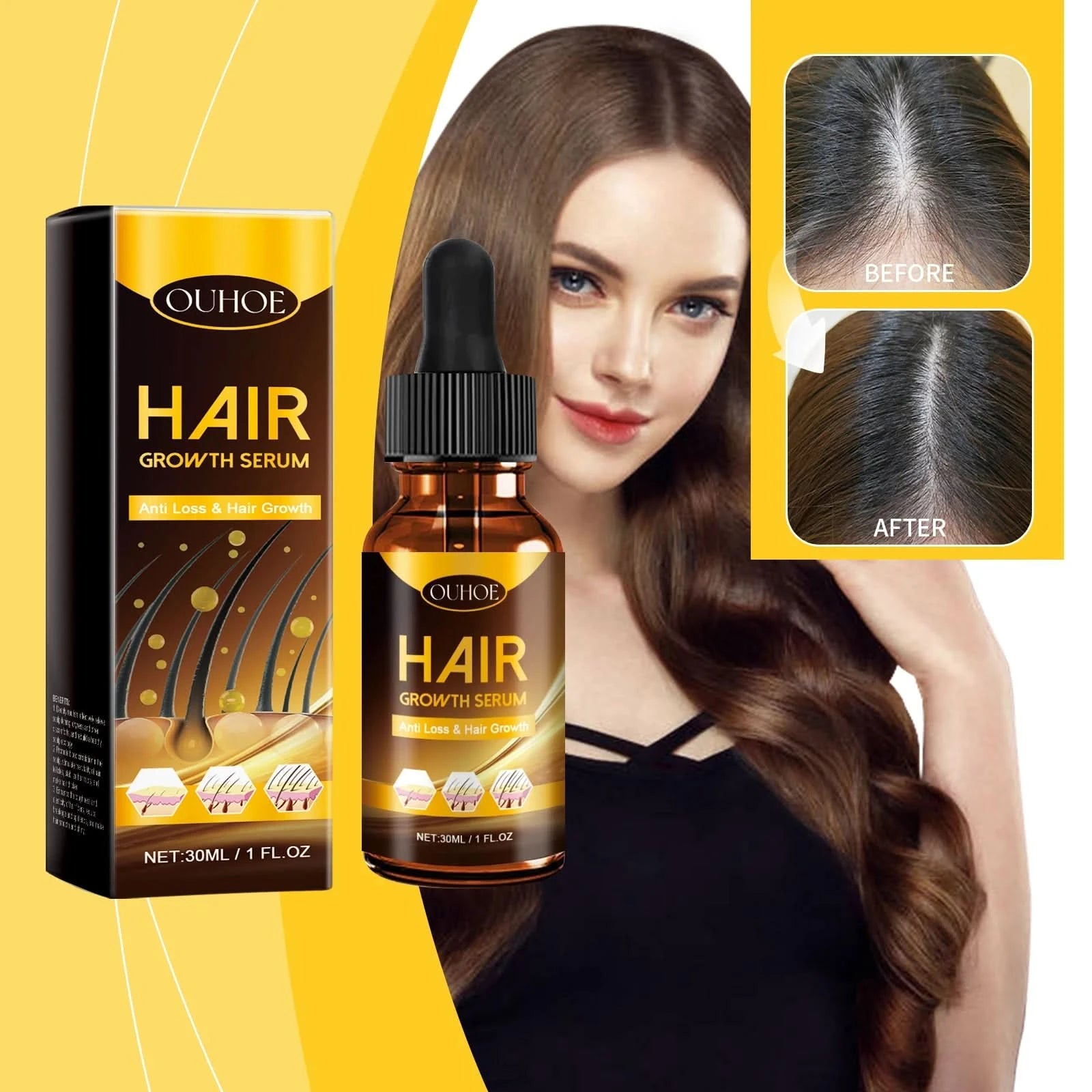 Hair Follicle Essence Deep Repair Damage Nourishing Growth Smoothing Oil Promote Regeneration Hydrate Fixing Dense Hair Products - M & M Global