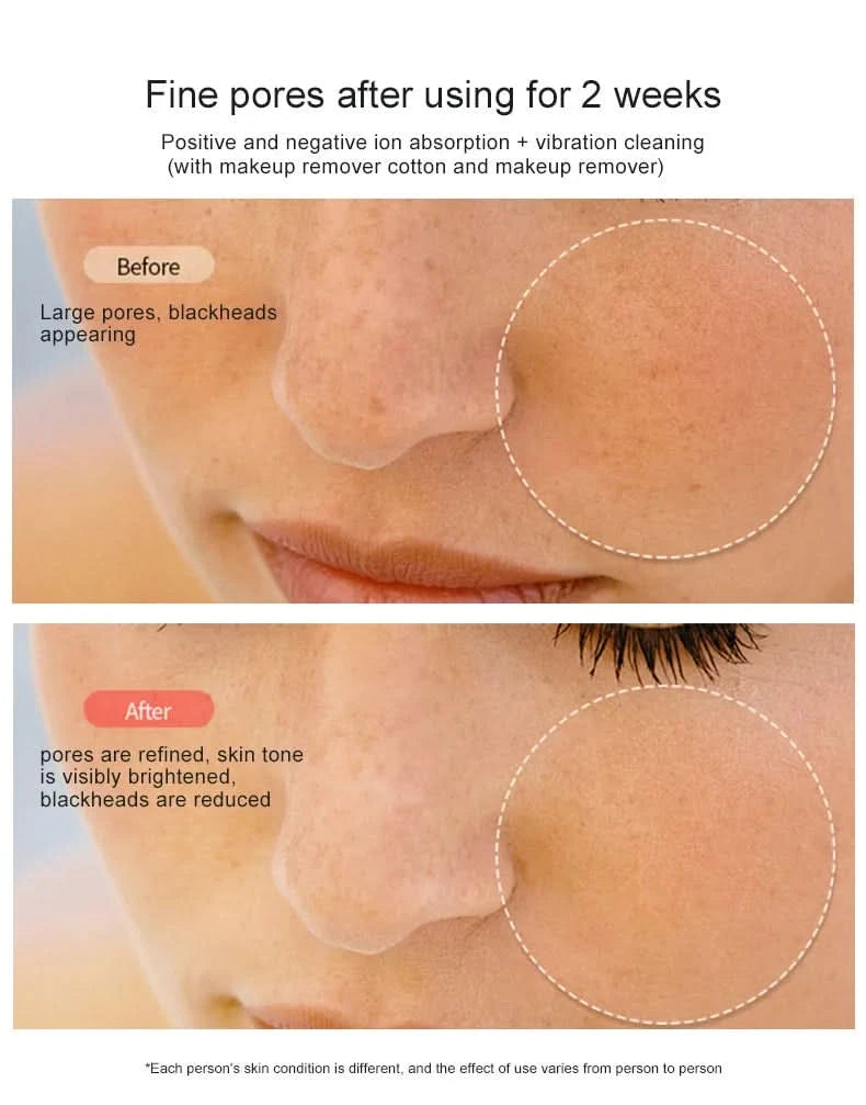 New Facial Lifting and Firming Rejuvenation RF Beauty device Home Face  device  EMS Microcurrent Beauty device Gift - M & M Global