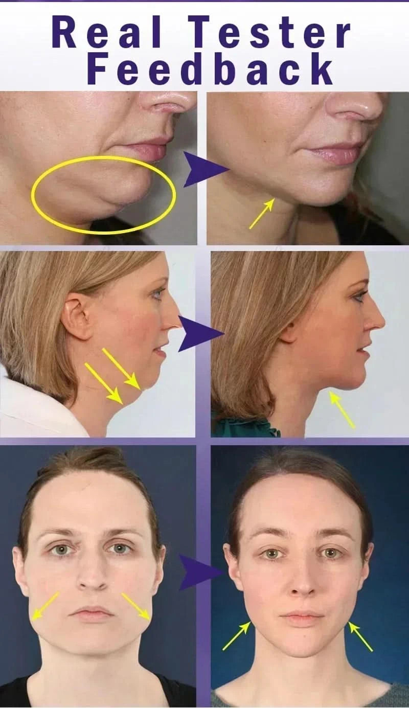 Effective V-Shape Face Slimming Lifting Facial Cream Lift Up V Double Chin Cheek Slimming Firming Anti Wrinkle Beauty Skin Care - M & M Global