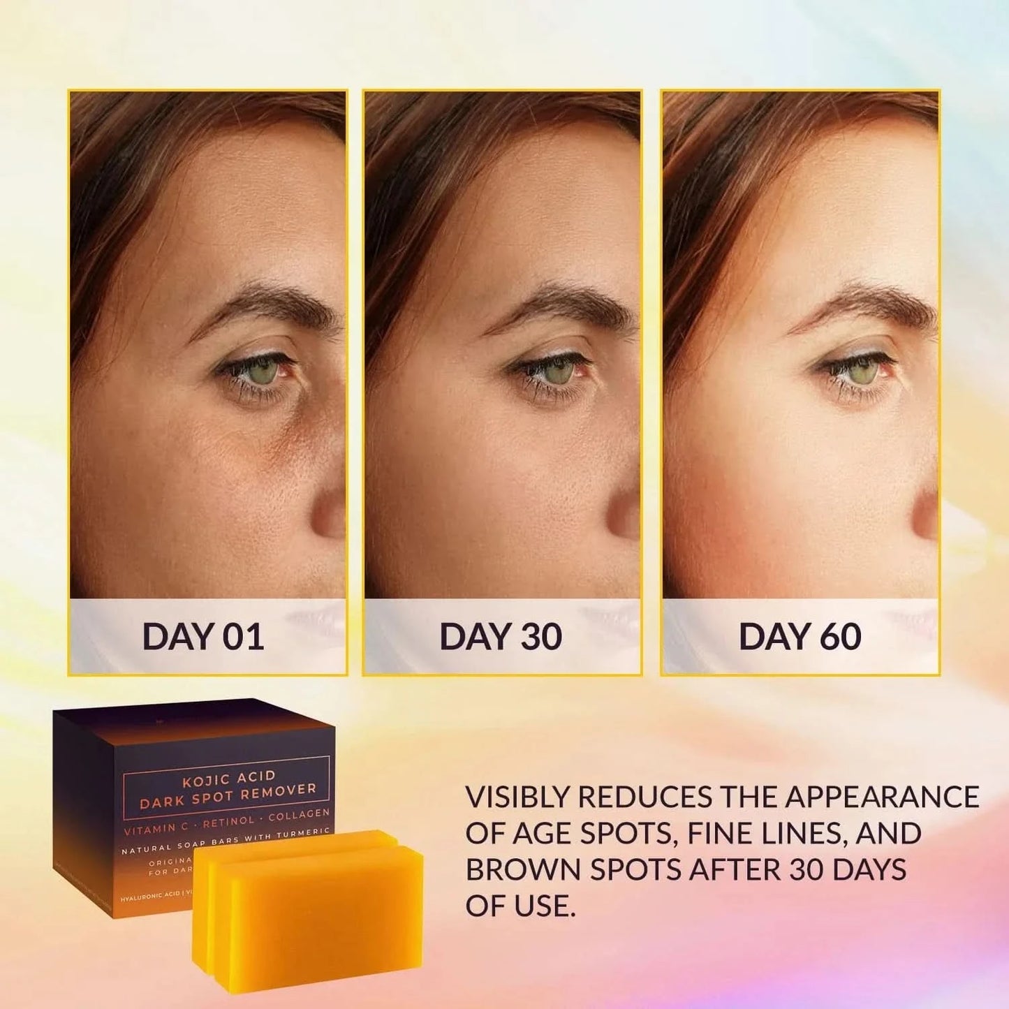 Kojic Acid Dark Spot Remover Whitening Soap Handmade Skin Care Deep Cleaning Moisturizing Cleansing Essential Soap Brighten Skin - M & M Global