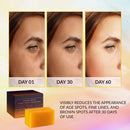 Kojic Acid Dark Spot Remover Whitening Soap Handmade Skin Care Deep Cleaning Moisturizing Cleansing Essential Soap Brighten Skin - M & M Global