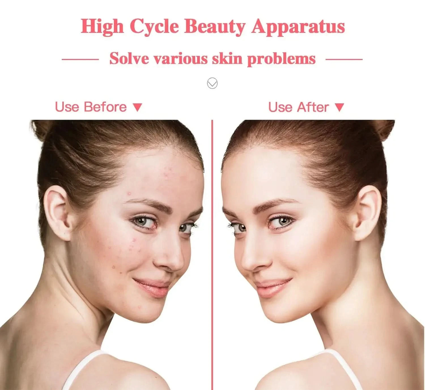 Portable High Frequency Facial Machine Skin Therapy Acne Spot Wrinkles Remover Beauty Facial Care Acne Spot Wrinkles Remover - M & M Global
