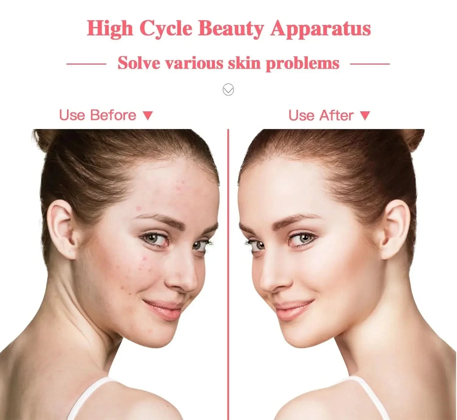 Portable High Frequency Facial Machine Skin Therapy Acne Spot Wrinkles Remover Beauty Facial Care Acne Spot Wrinkles Remover - M & M Global