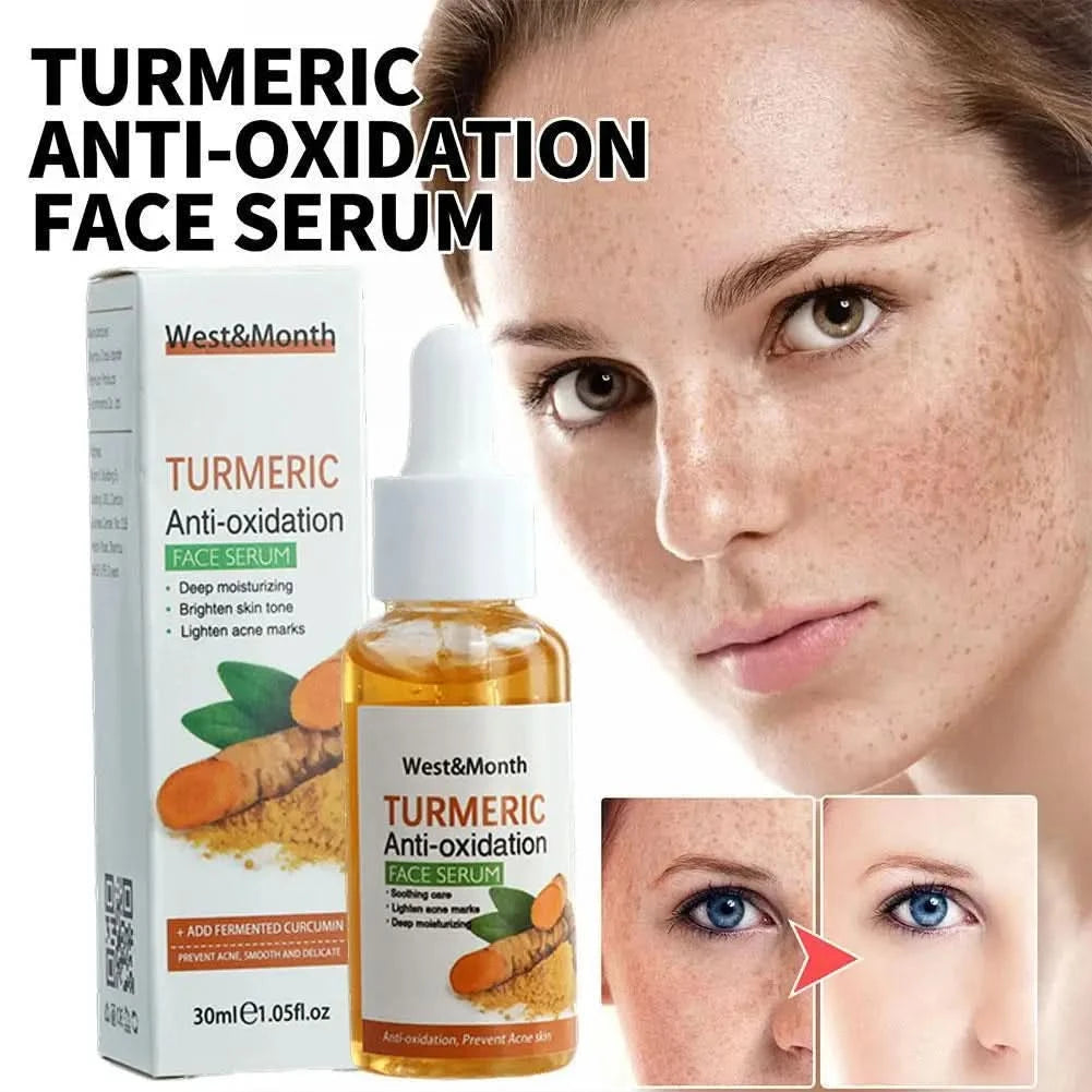 Turmeric Face Whitening Serum Turmeric Anti-oxidation Serum Turmeric Dark Spot Corrector Serum Facial Brighten Turmeric Oil Soap - M & M Global