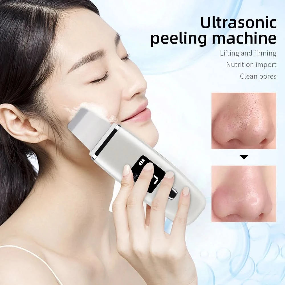 Ultrasonic Skin Scrubber Facial Spatula Blackhead Remover Deep Face Cleaning Lift Machine Peeling Shovel Pore Cleaner - M & M Global