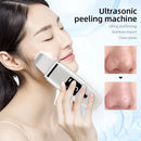 Ultrasonic Skin Scrubber Facial Spatula Blackhead Remover Deep Face Cleaning Lift Machine Peeling Shovel Pore Cleaner - M & M Global