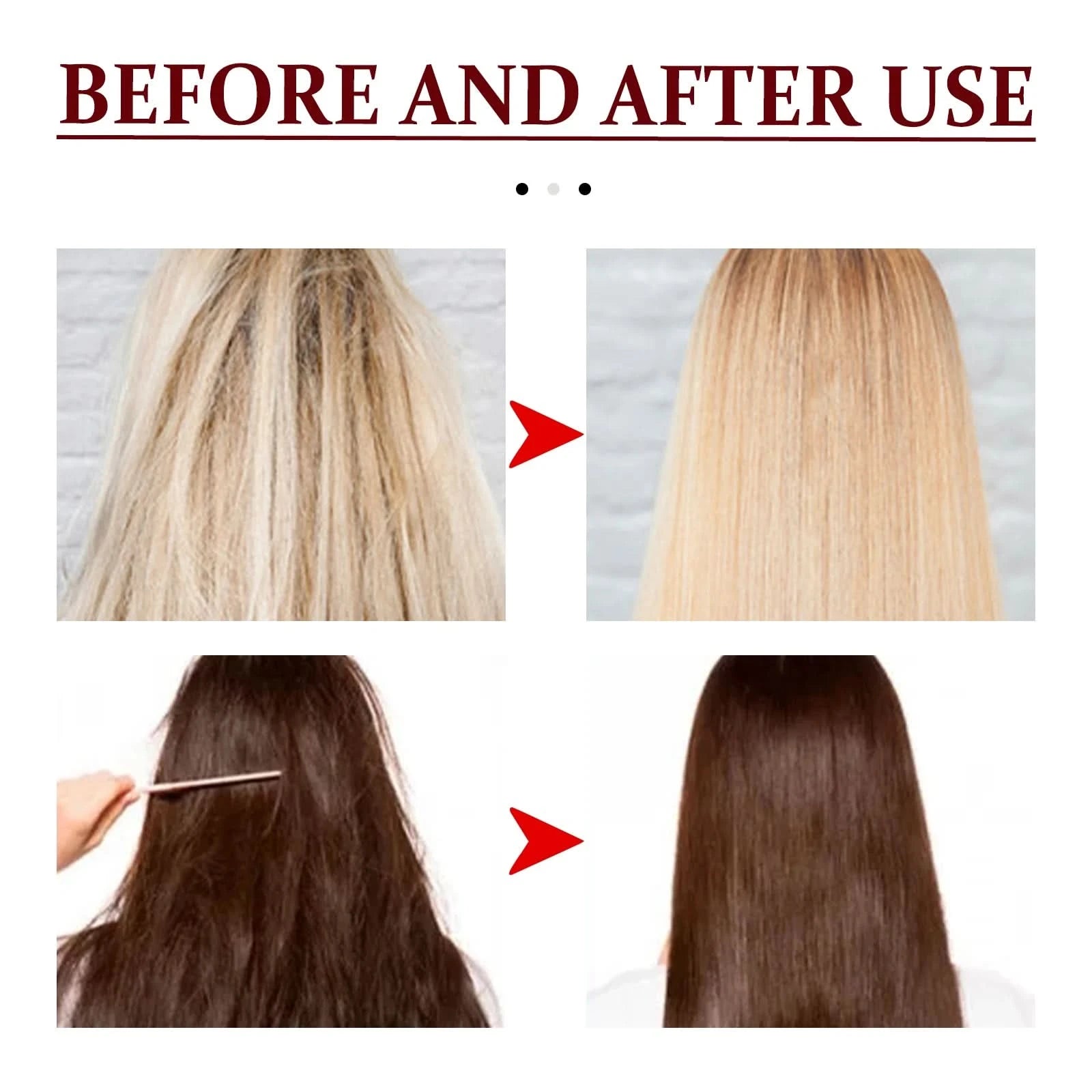 Hair Shampoo For Tinea Capitis Antipuriticprofessional Antidandruff Remove Mites Andrelieve Itching Shampoo 100ml Party Favours - M & M Global