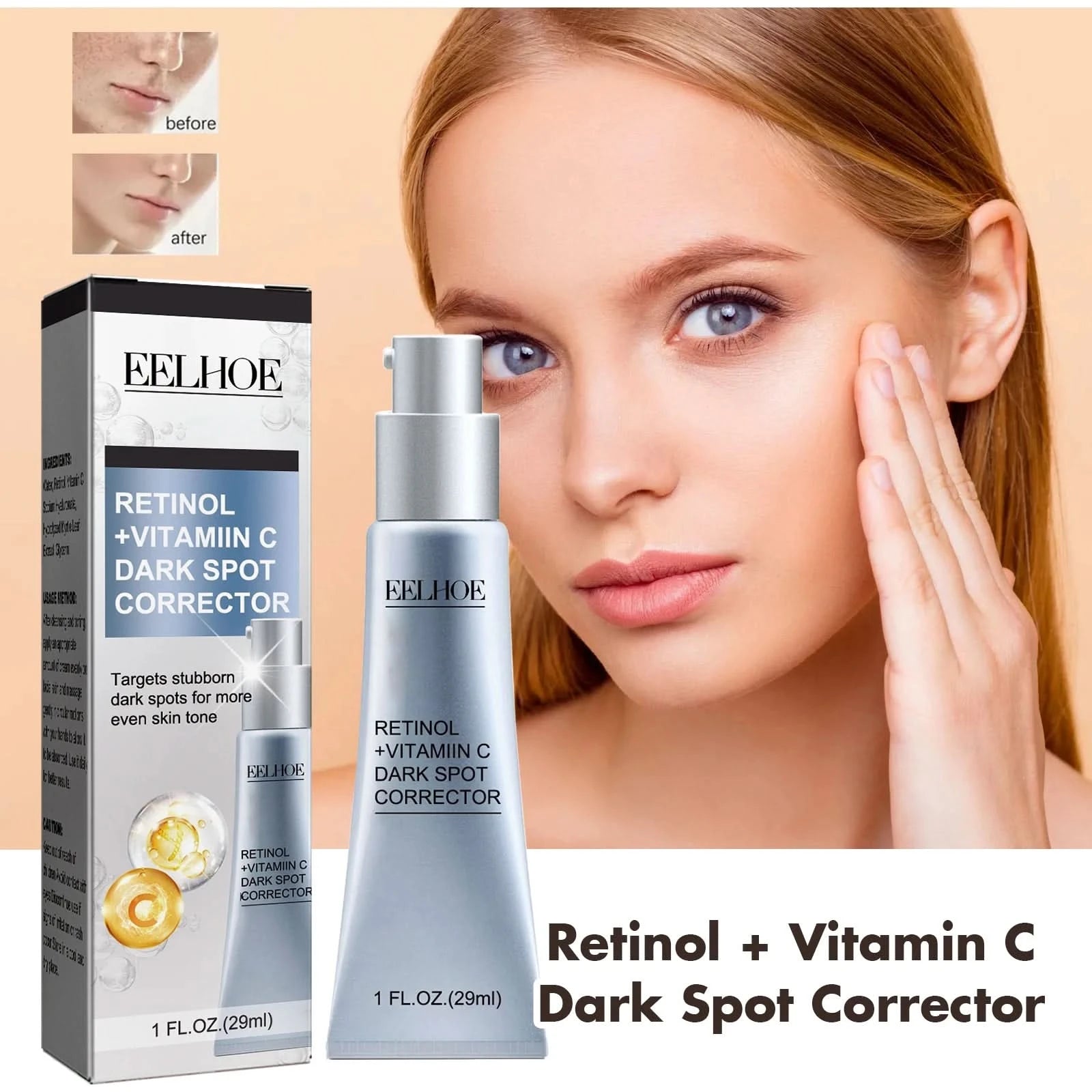 Women Fade Melasma Cream Lightening Dull Brightening Emulsion Remove Dark Stains Brighten Cream Dark Skin Moisturize Products - M & M Global
