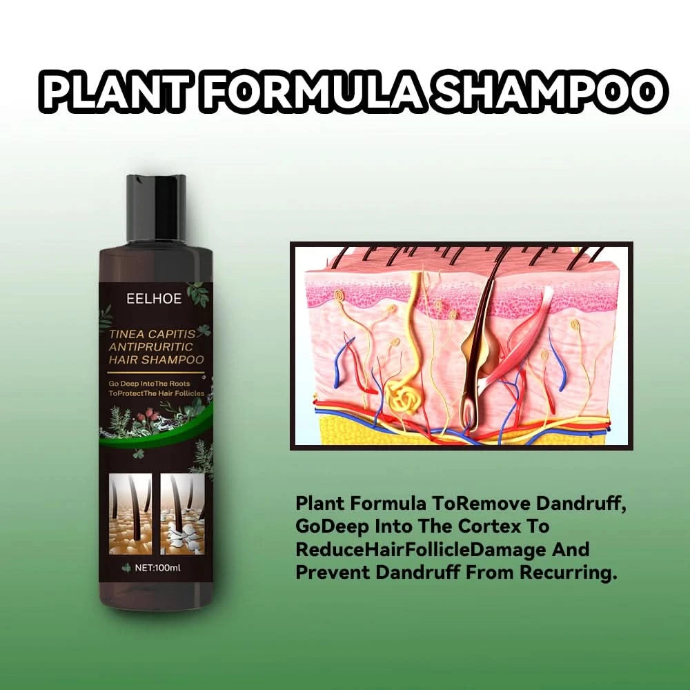 Hair Shampoo For Tinea Capitis Antipuriticprofessional Antidandruff Remove Mites Andrelieve Itching Shampoo 100ml Party Favours - M & M Global
