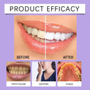 6ml Teeth Whitening Pen Teeth Gel Whitener Bleach Remove Stains Oral Hygiene Instant Smile Teeth Whitening Cleansing Serum - M & M Global