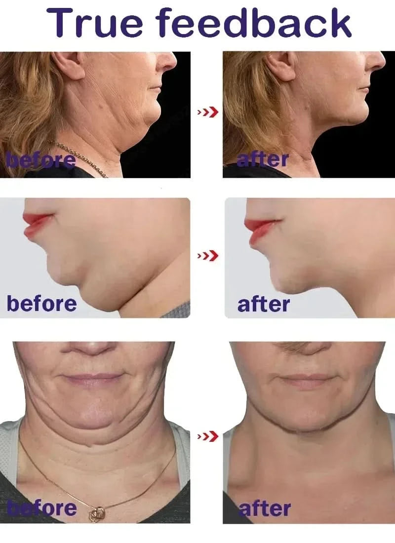 Effective V-Shape Face Slimming Lifting Facial Cream Lift Up V Double Chin Cheek Slimming Firming Anti Wrinkle Beauty Skin Care - M & M Global